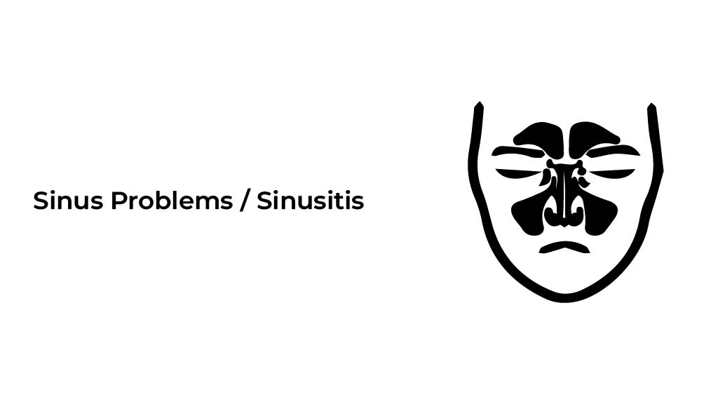 Sinus-Problems-Sinusitis